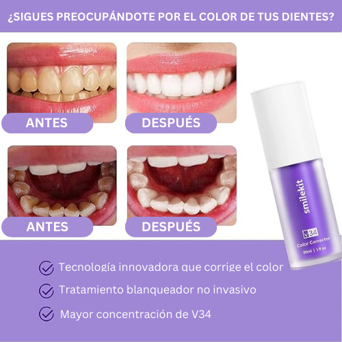 Blanqueador SmileKit Dental